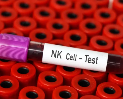 Before NK Cell Infusion