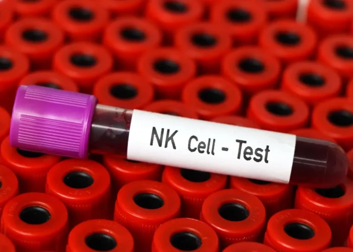 Before NK Cell Infusion