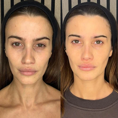 Brighter & Glowing Skin